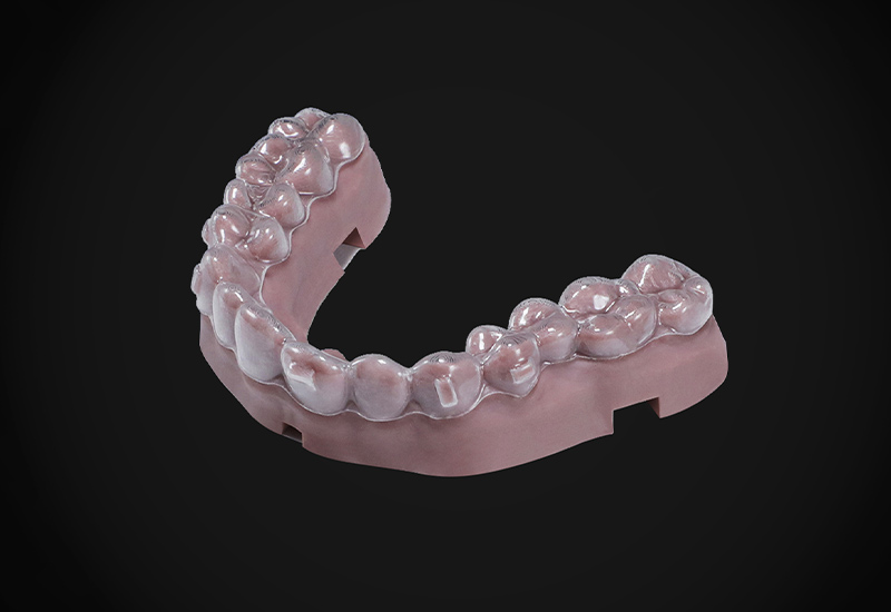 什么是正畸牙模？3d打印正畸牙模怎么做呢？