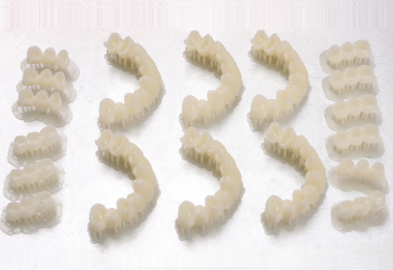 3d打印臨時牙冠多少錢？